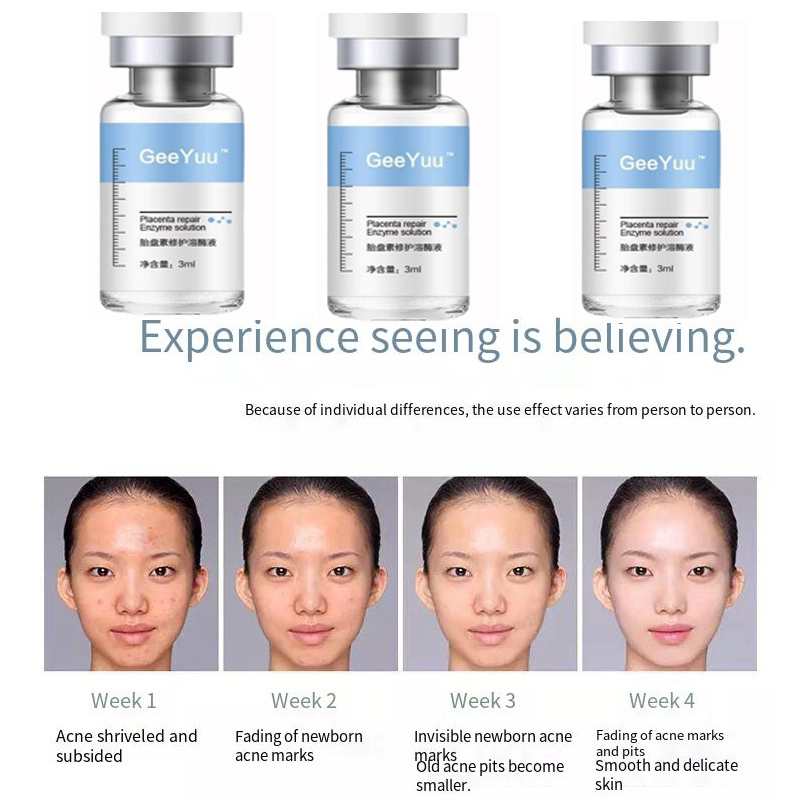 Placent Peptide Ampoule Hyalur - đánh giá và giá Placenta Extract Serum